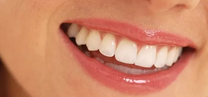 the difference between traditional and hollywood smile procedures in turkey